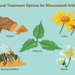 Treatment options for rheumatoid arthritis